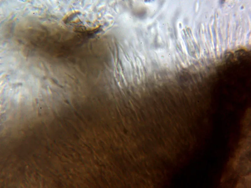 Cytospora longiostiolata 12 - Base e hifas conidiógenas